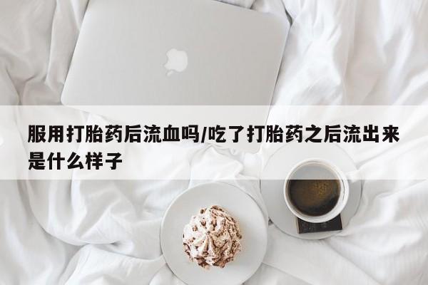 网上哪里有卖打胎药的联系方式服用打胎药后流血吗/吃了打胎药之后流出来是什么样子